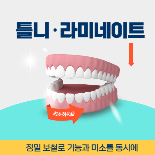 안성치과 안성시 치과 틀니 라미네이트