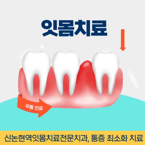 안성치과 안성시 치과 잇몸치료